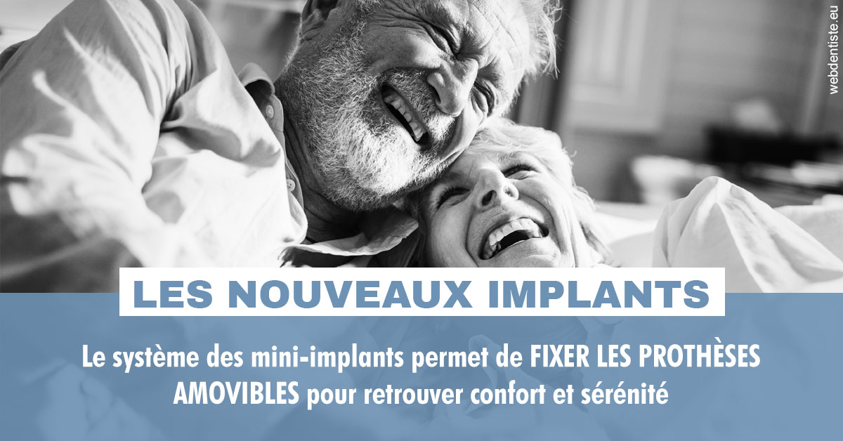 https://www.agoradent.fr/Les nouveaux implants 2