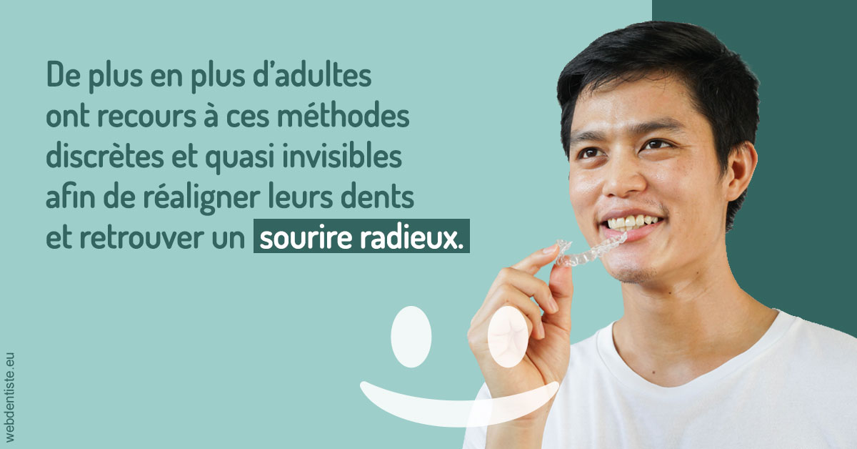 https://www.agoradent.fr/Gouttières sourire radieux 2