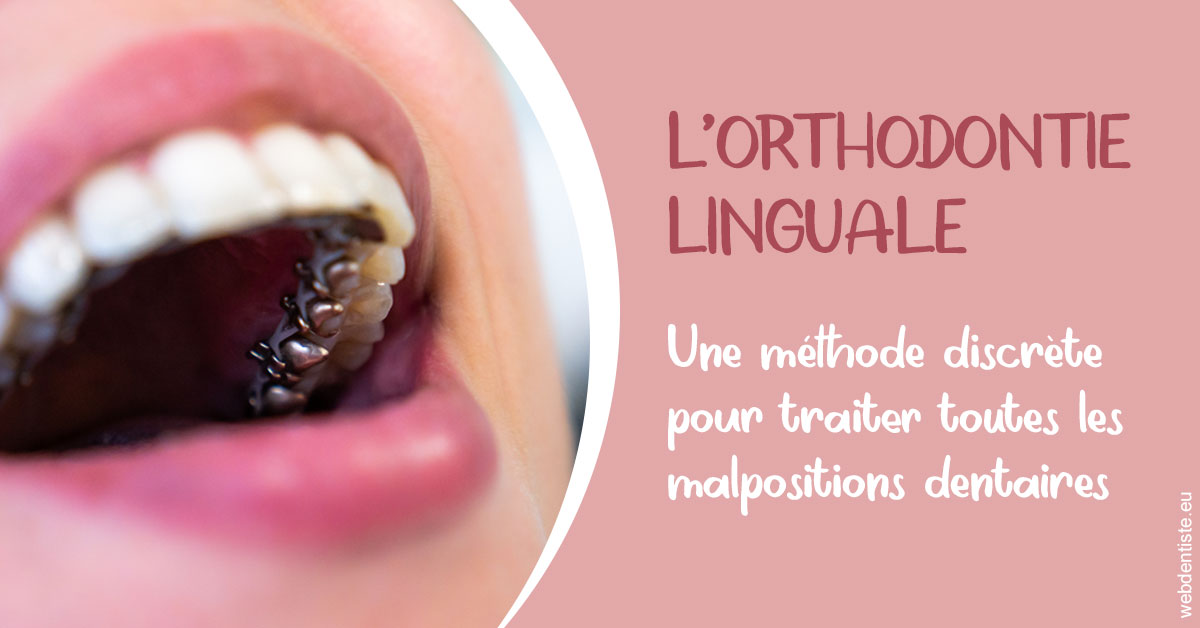 https://www.agoradent.fr/L'orthodontie linguale 2