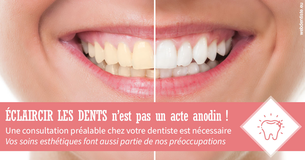 https://www.agoradent.fr/Eclaircir les dents 1
