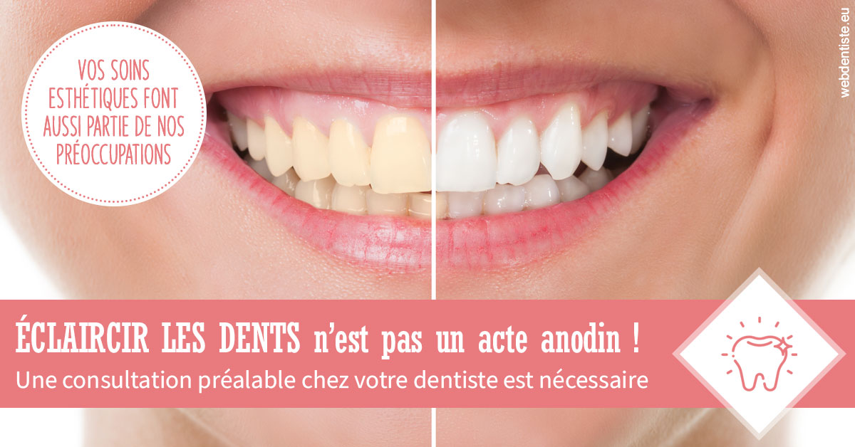 https://www.agoradent.fr/Eclaircir les dents 1