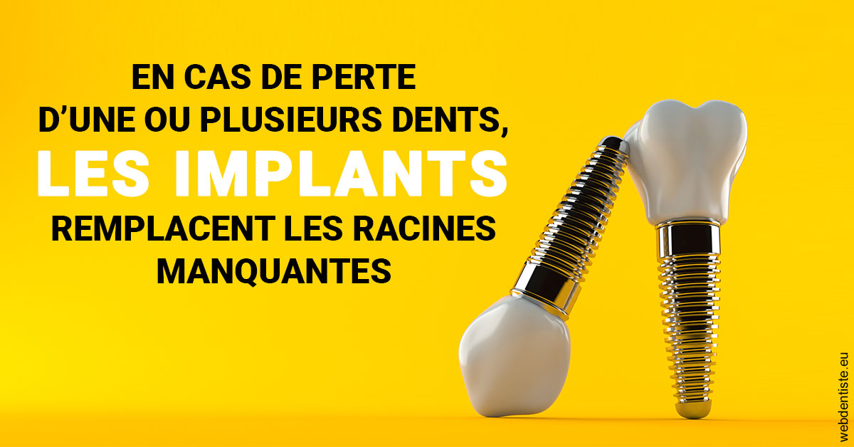 https://www.agoradent.fr/Les implants 2